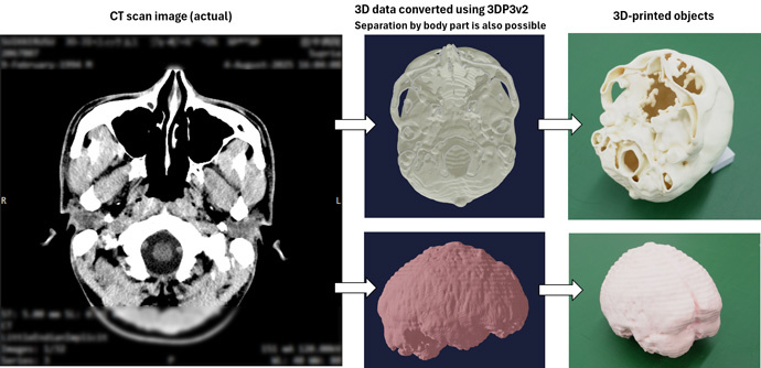 Fig 6. Example workflow from CT scan data to 3D printing
